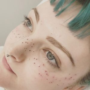Freckle Tattooing